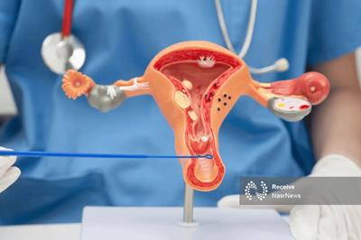 ابتلا به سرطان دهانه رحم از نوجوانی آغاز می‌شود