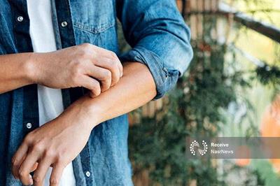 چرا نباید جای نیش حشرات را بخارانیم؟